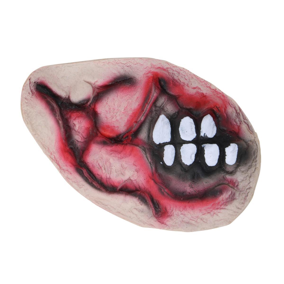 Cicatrice bocca storta