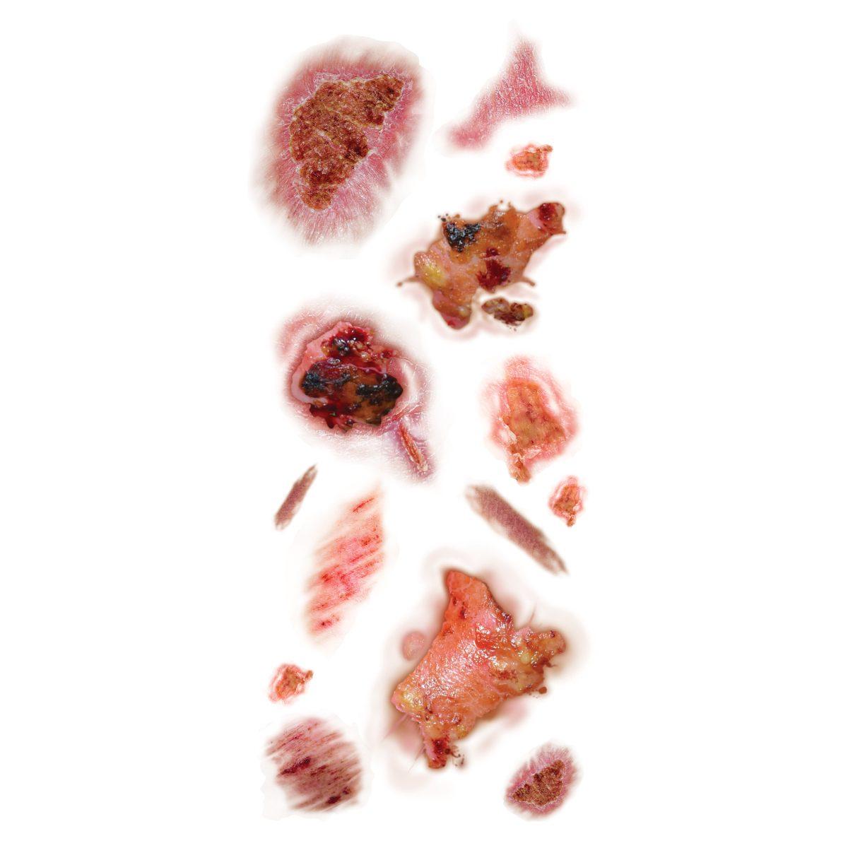 Tatuaggi corpo rimovibili ferite infette
