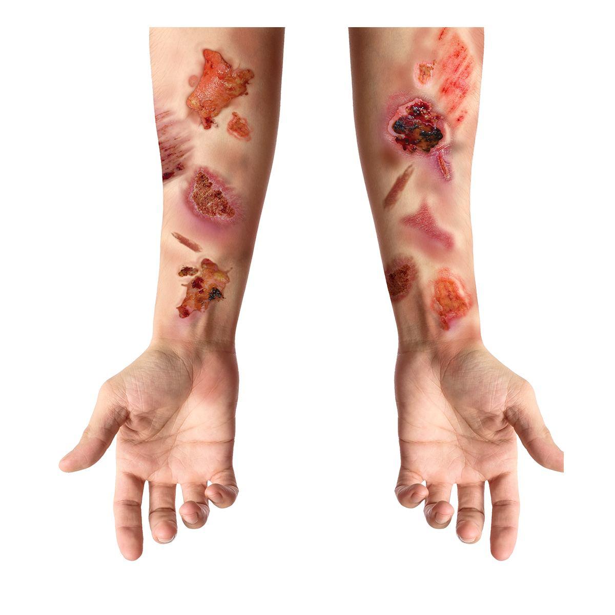 Tatuaggi corpo rimovibili ferite infette