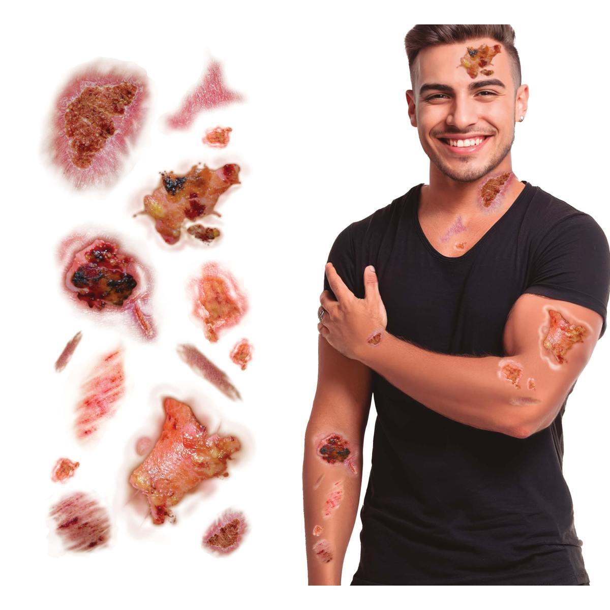 Tatuaggi corpo rimovibili ferite infette